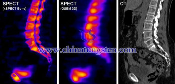 高比重鎢合金准直器用於SPECT系統圖片