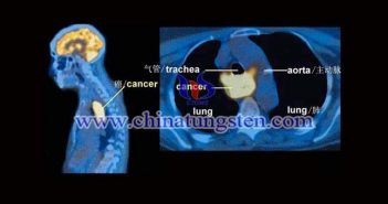 PET-CT tungsten alloy collimator picture