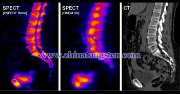 开云app官网下载安卓版
准直器用于SPECT系统图片